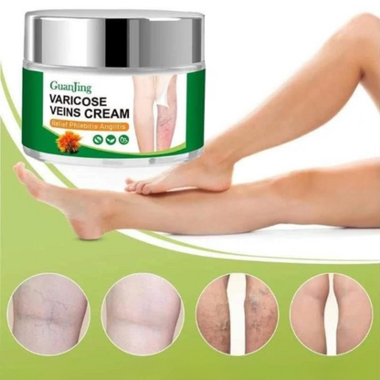 VénaPura® -Crema para Várices  35% de DESCUENTO HOY