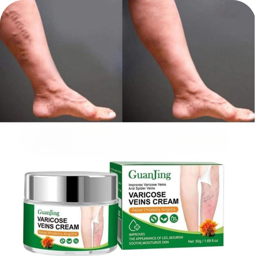 VénaPura® -Crema para Várices  35% de DESCUENTO HOY
