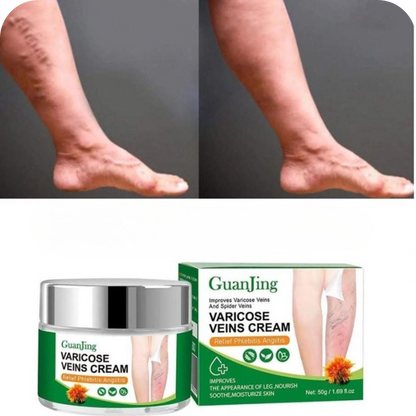 VénaPura® -Crema para Várices  35% de DESCUENTO HOY