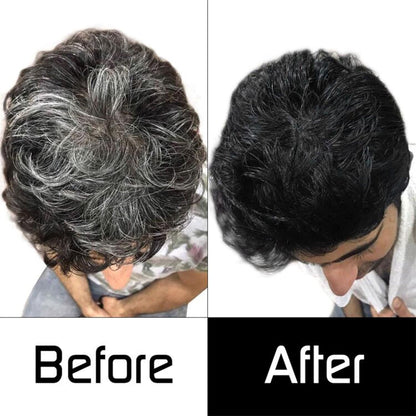 Anti-Canas Premium - Especial para hombres