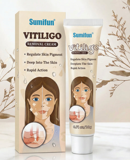 VitiTone Cream - Vitiligo